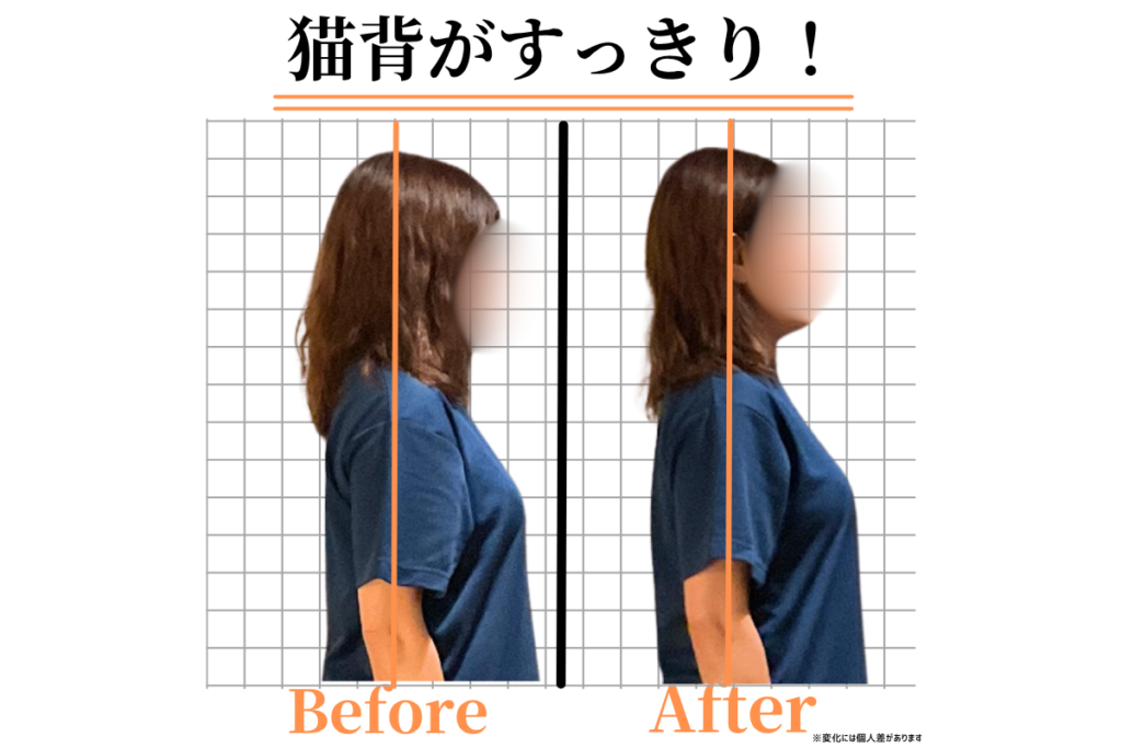 猫背がすっきりし、横から見た姿勢にも変化